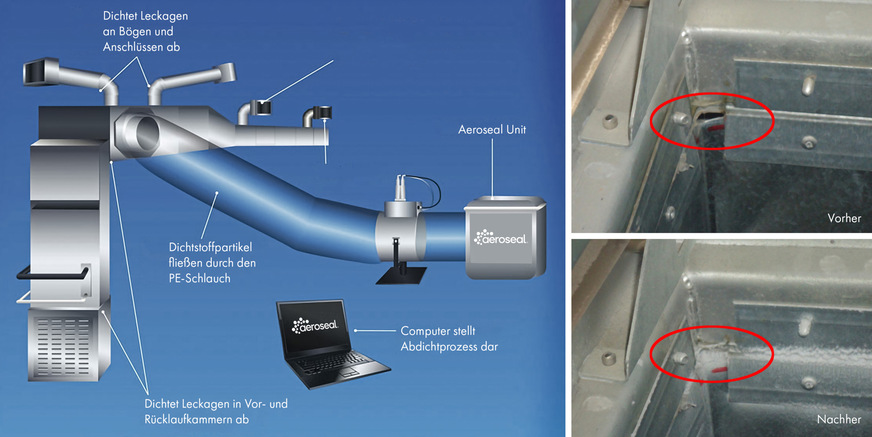 Bild 6 Funktionsprinzip des Aeroseal-Verfahrens.