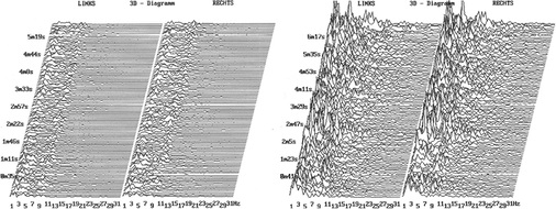 <p>
</p>

<p>
<span class="GVAbbildungszahl">4</span>
 Der Erfolg einer Harmonisierung gegen Elektrosmog wird anhand einer Gehirnstrommessung mittels Elektroenzephalograph gemessen; links die Graphik der Gehirnströme eines Probanden vor der Entstörung, rechts nach der Entstörung seines Büroarbeitsplatzes. 
</p> - © IKG

