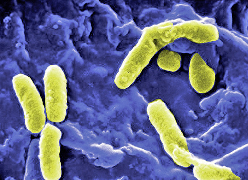 



5
 Da Bakterien in einem nicht kultivierbaren Zustand (VBNC) im Biofilm unentdeckt bleiben können, ist bei konkreten Prädikatoren die mikroskopische Auszählung der Gesamtzellzahl zu empfehlen. 
