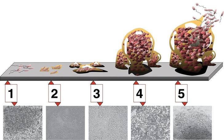 Abb. 1 Entwicklung von Biofilm in Rohrleitungen, aus: Monroe D (2007) Looking for Chinks in the Armor of Bacterial Biofilms. PLoS Biol 5(11): e307. - © Redo Water Systems
