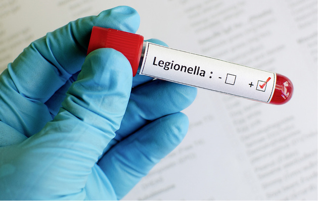 



1
 Legionellen im Trinkwasser lassen sich technisch nicht ausschließen. Das Regelwerk zielt deshalb darauf ab, durch definierte Temperaturen einer kritischen Vermehrung in der Trinkwasser-Installation vorzubeugen. 
